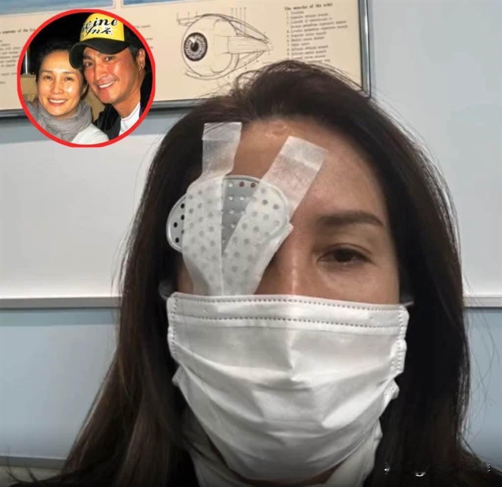 退圈25年！高金素梅突然公开独眼照，健康亮起红灯，开刀前的一个举动让全网心疼：请