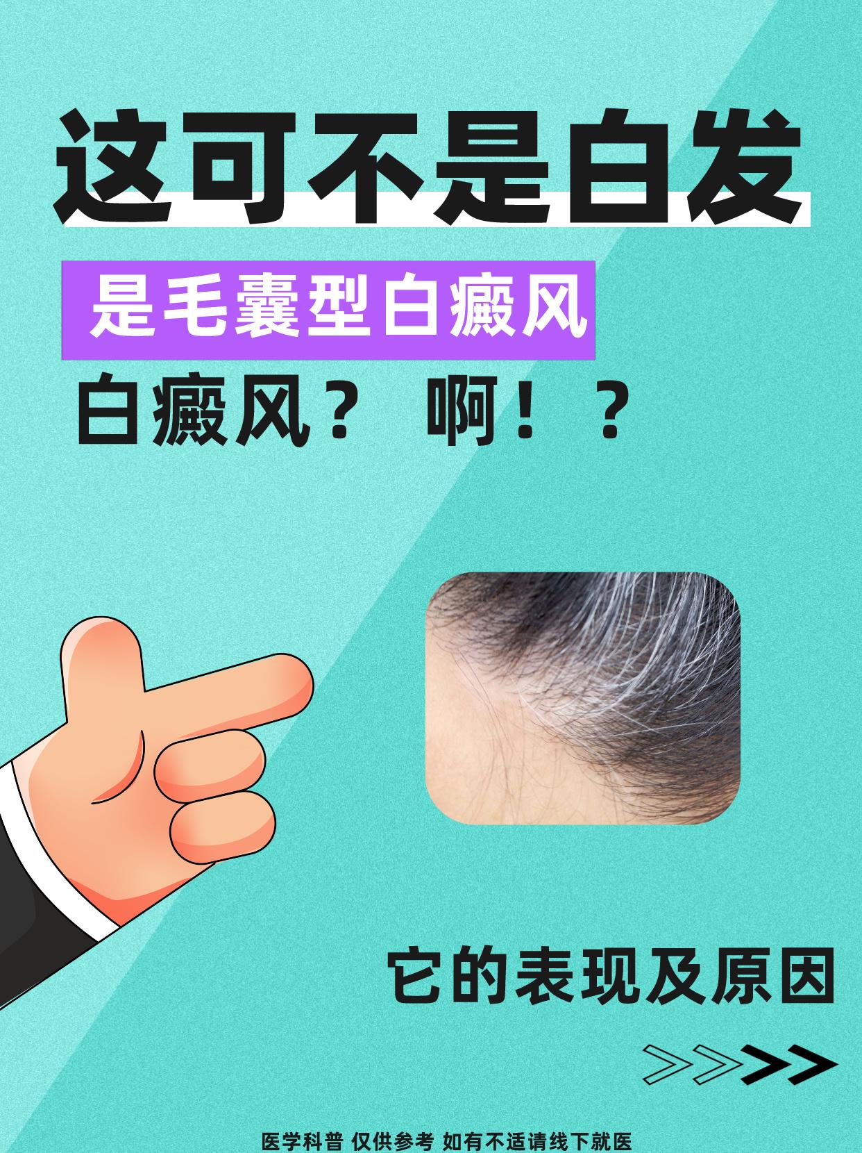 这可不是白发，是毛囊型白癜风！