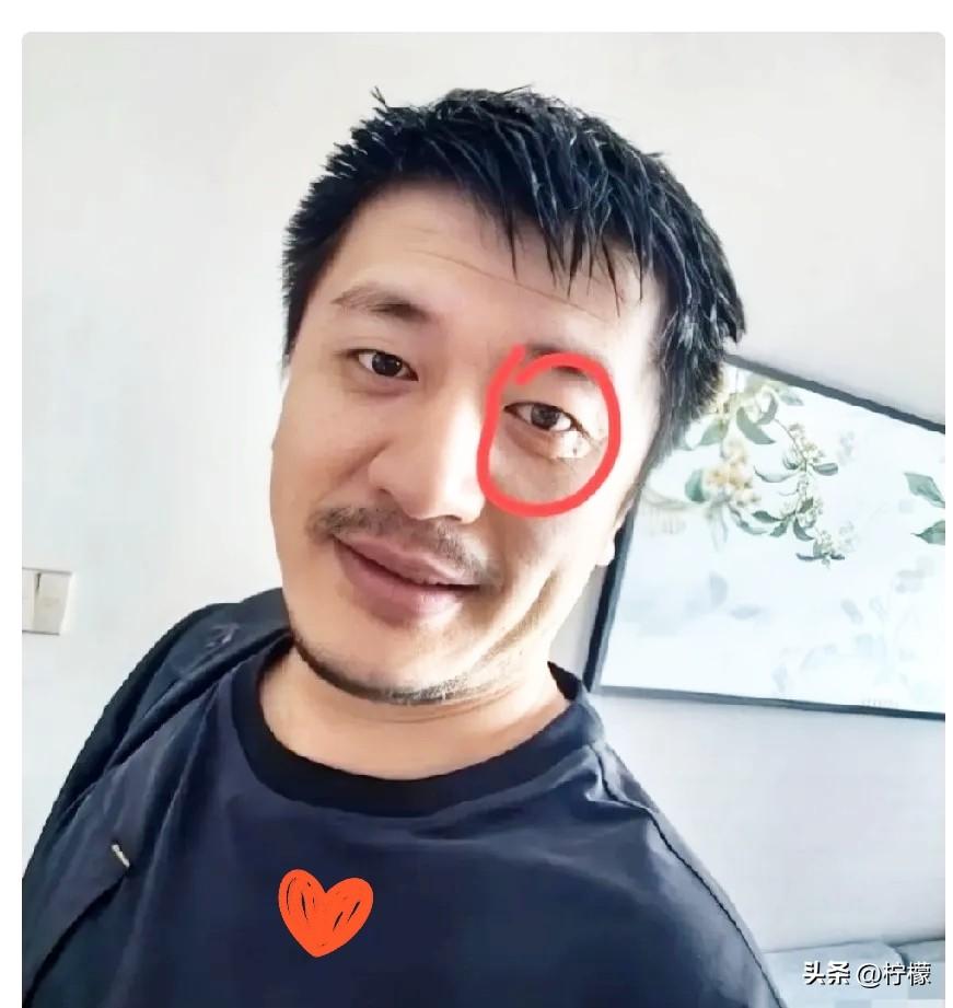 张雪峰身上还有个疑点，
想了一夜也没有想通，
就是他有专业的护理团队，按说这种事