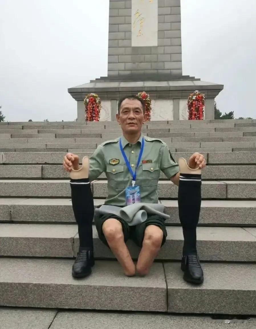 对越自卫反击战一等臣,残运冠军和先进私营企业家郑守勇，他身残志坚、自强不息,用军