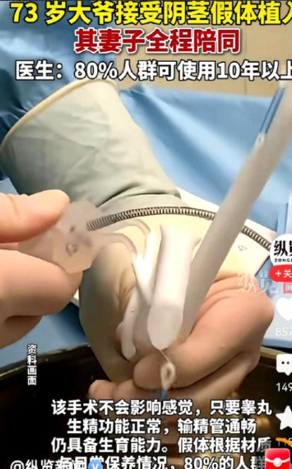 73岁男子为比自己小30多岁的妻子改善夫妻生活，主动接受阴茎假体植入手术，不少网