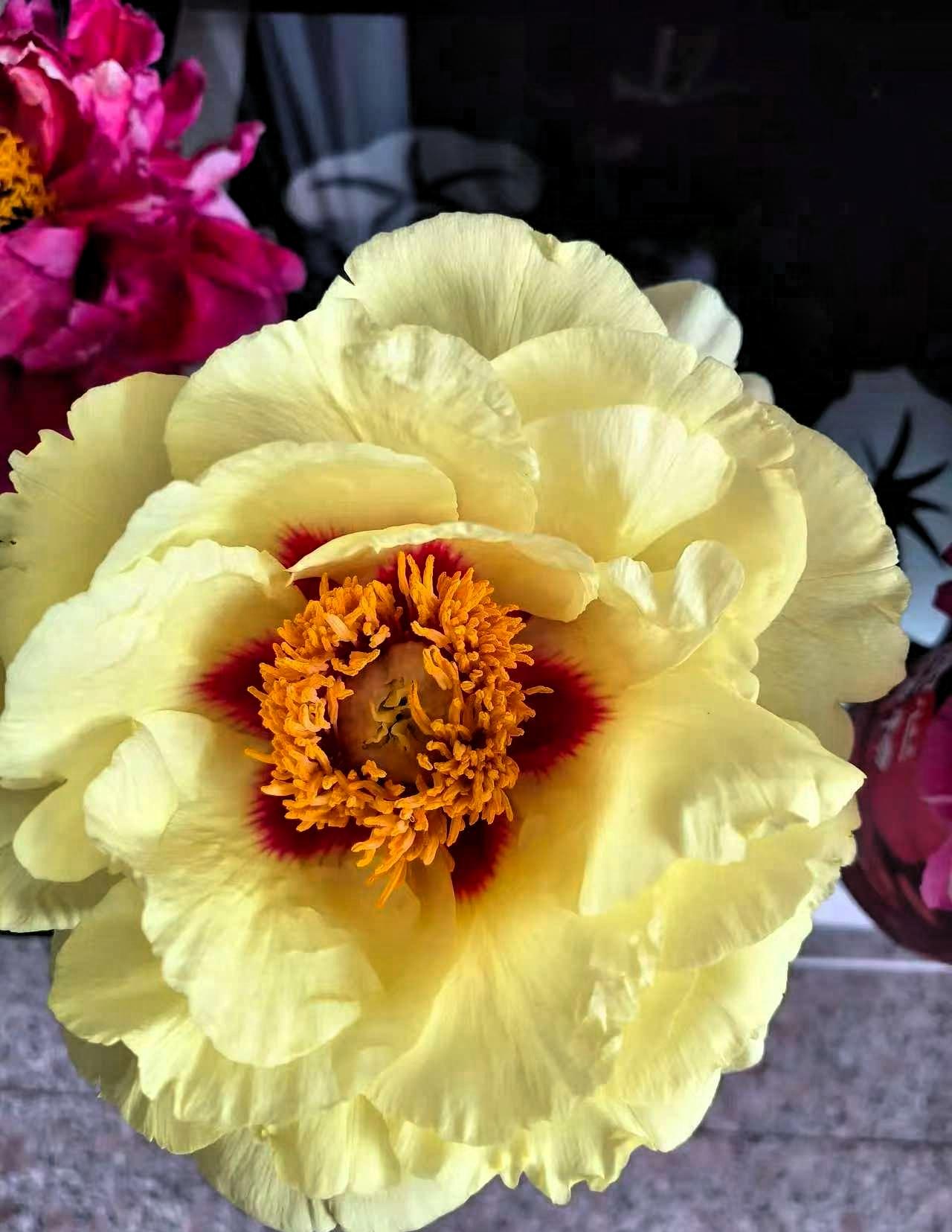 别染发，别染发，别染发， 4月15日，主持人尼格买提晒出眼部严重肿胀的照片，简单