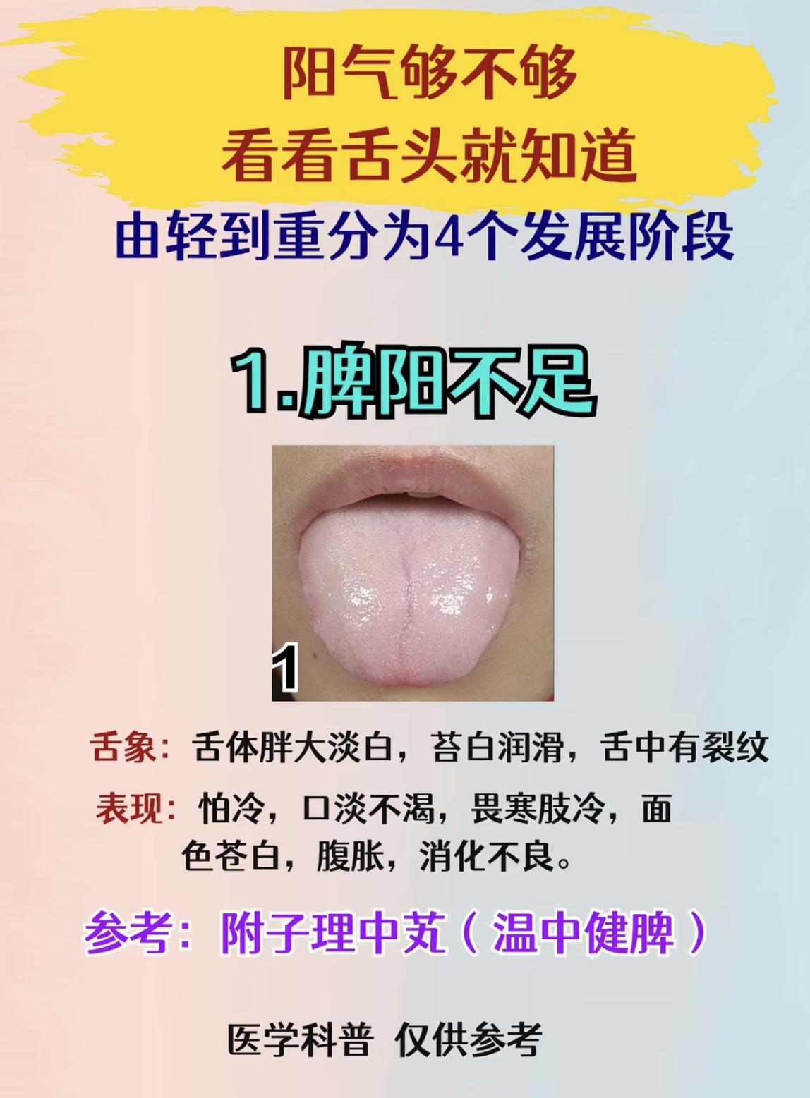 体内阳气够不够，看看舌头就知道！
#健康##中医##舌诊##调理身体#