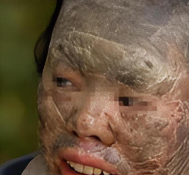 吃蛇太多变蛇人？2003年辽宁省，村民韩永波有个特殊的爱好——爱吃蛇，不仅顿顿有