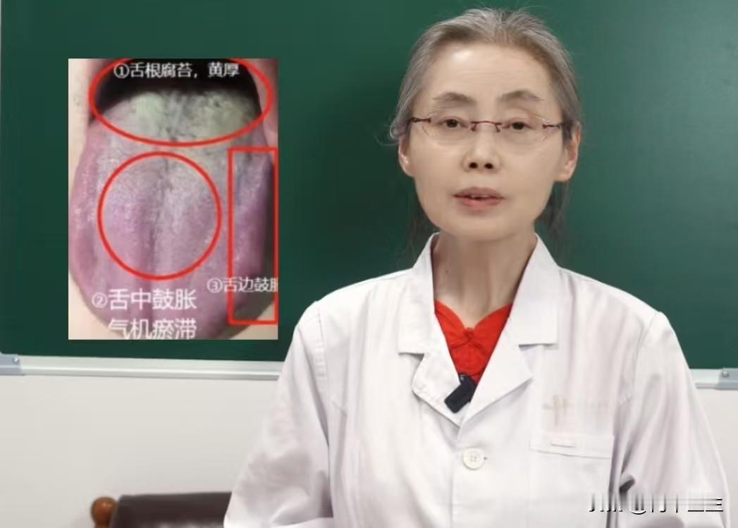 男人行不行怎么看?舌象就看这两处

患者主诉：宗筋疲软无力，时间短，平时容易烦躁