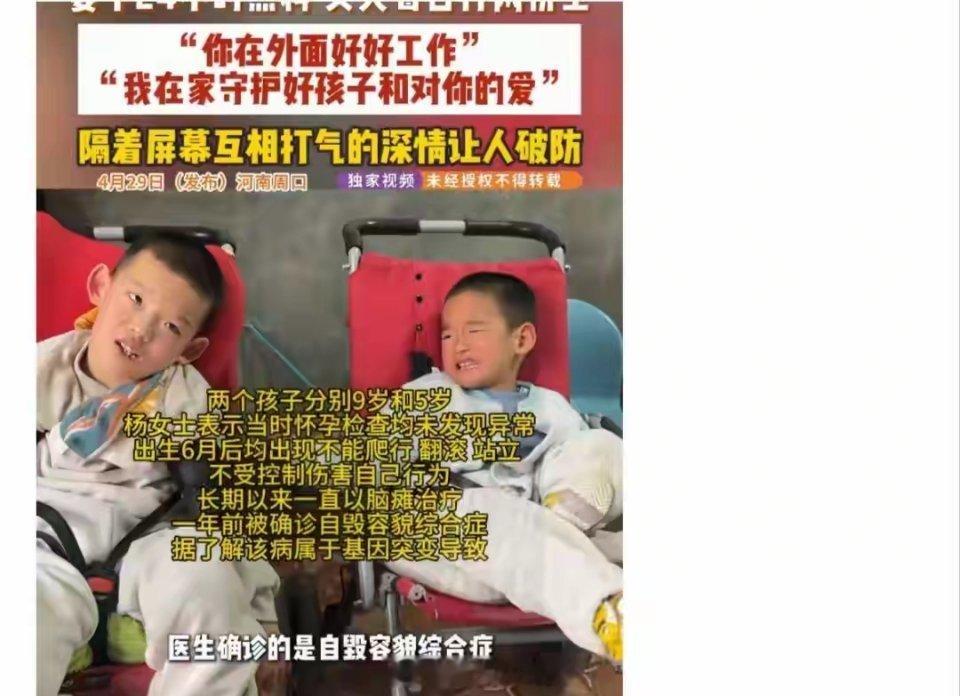 兄弟俩基因突变总不受控制乱咬太心疼了！本该无忧无虑的兄弟俩却被罕见病狠狠困住他们