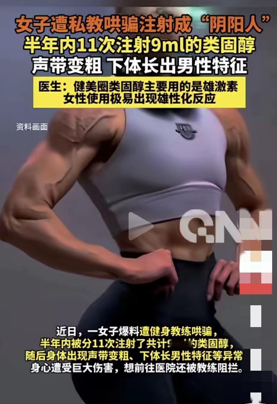 丧心病狂！女子被私教哄骗打“科技针”变“阴阳人”。
20多岁的女孩一心想练出好身