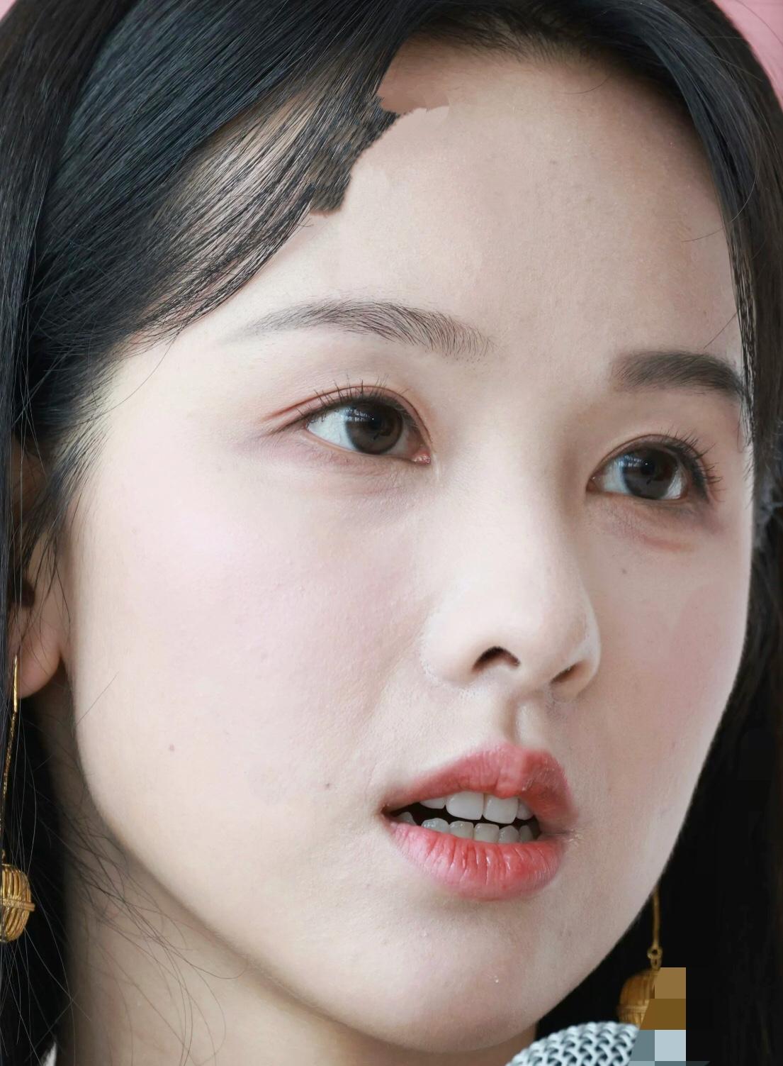 女明星也不能解决法令纹问题吗