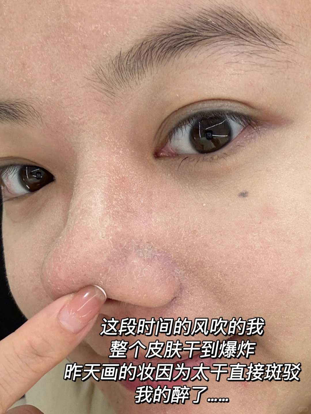 没人比它更懂滋润！干燥起皮还有翻身机会