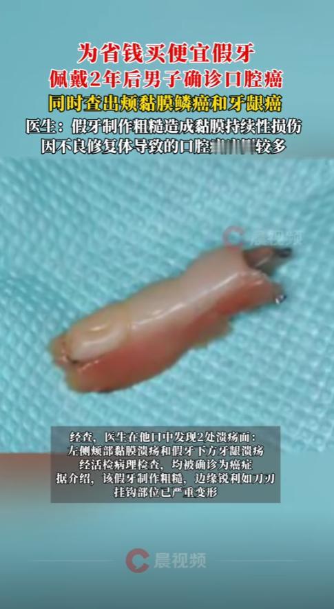 一副假牙的代价
“这下后悔了吧！”湖南长沙，一男子为了省钱，买了一副劣质的假牙老