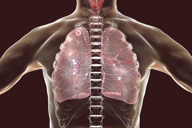 老家癌症病种变化值得细究，30年前食管癌最常见，现在全变了
我是苏北泗阳人，记得