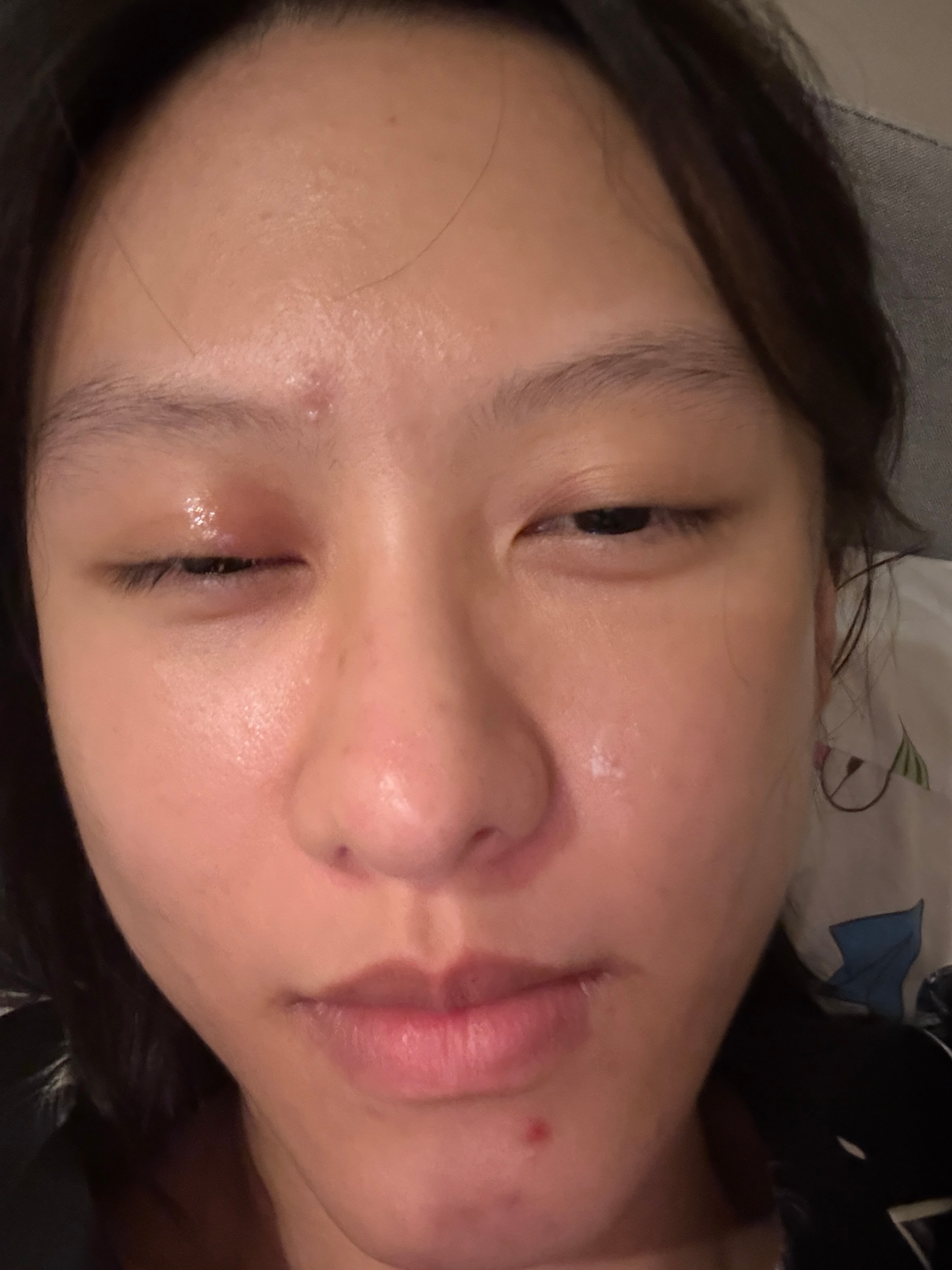 张大强 是我抵抗力弱 