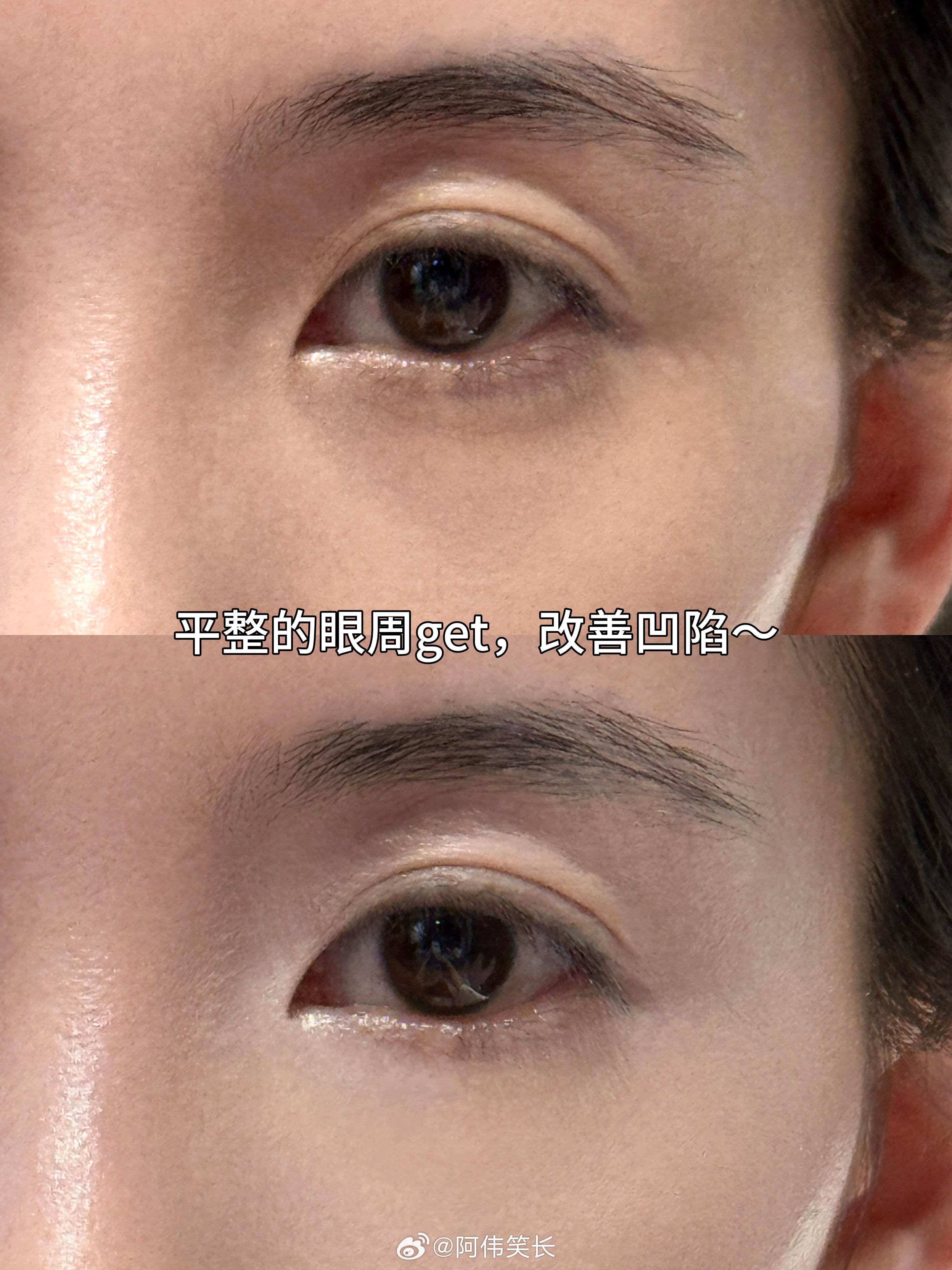 不会遮黑眼圈的有福了 