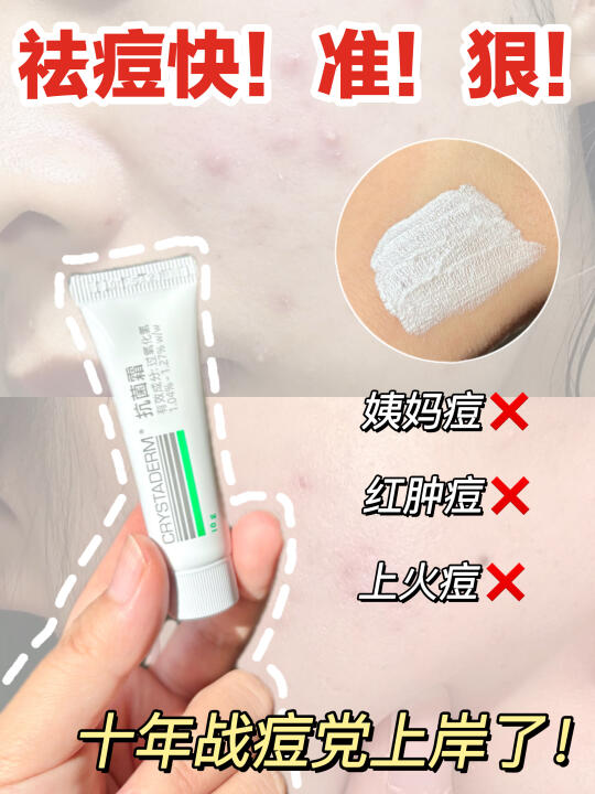 痘肌千万别乱用了！十年战痘党教你怎么选！