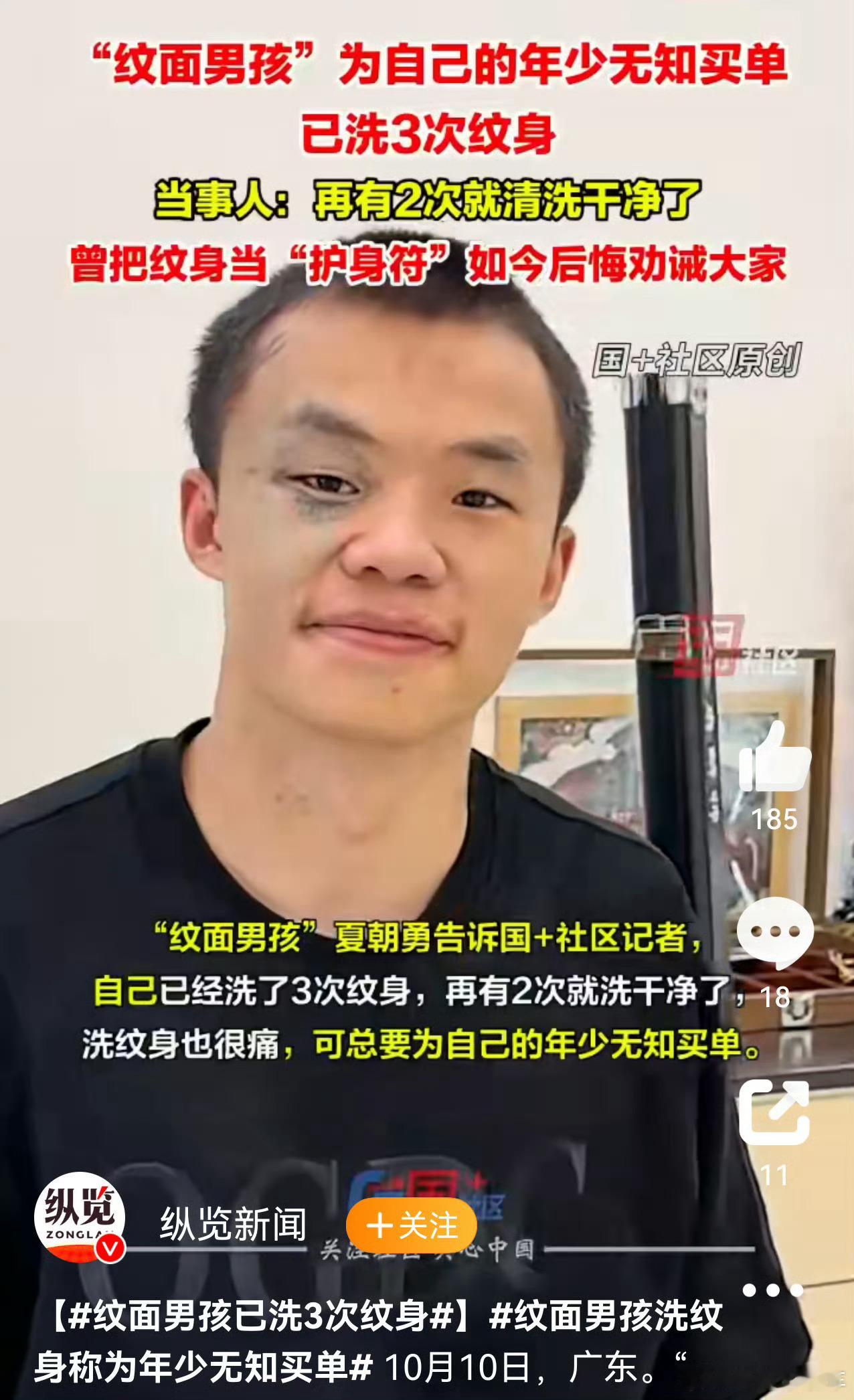 洗纹身比纹身疼多了，这是真的勇啊！👦 当初的“年少轻狂”，现在的“洗心革面”。