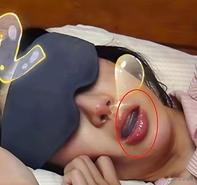 金晨在《花少》里睡觉都带着保持器，直接不装了！这一画面被曝光后，网友们炸开了锅。