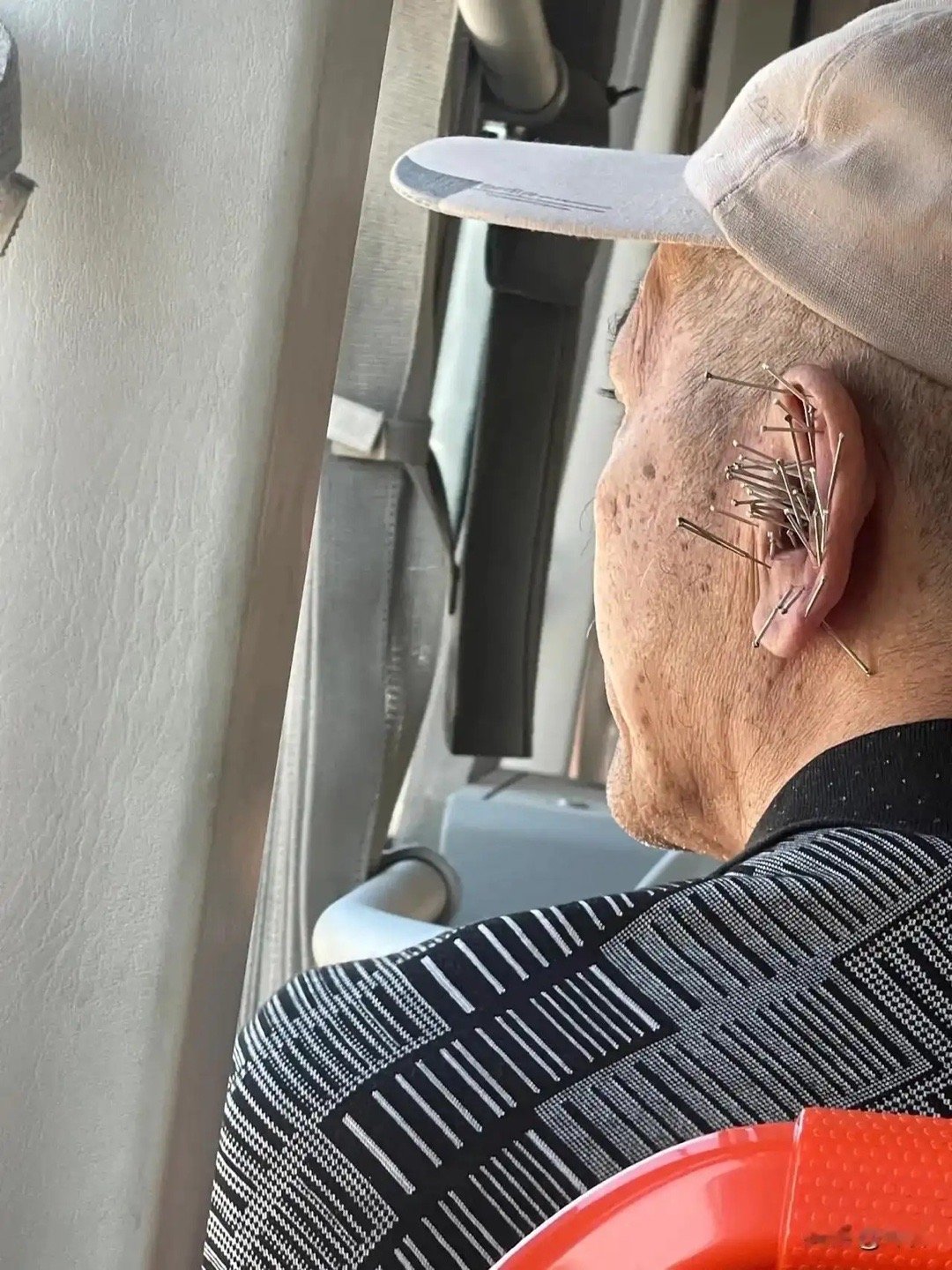 大爷耳朵怎么了 ​​​