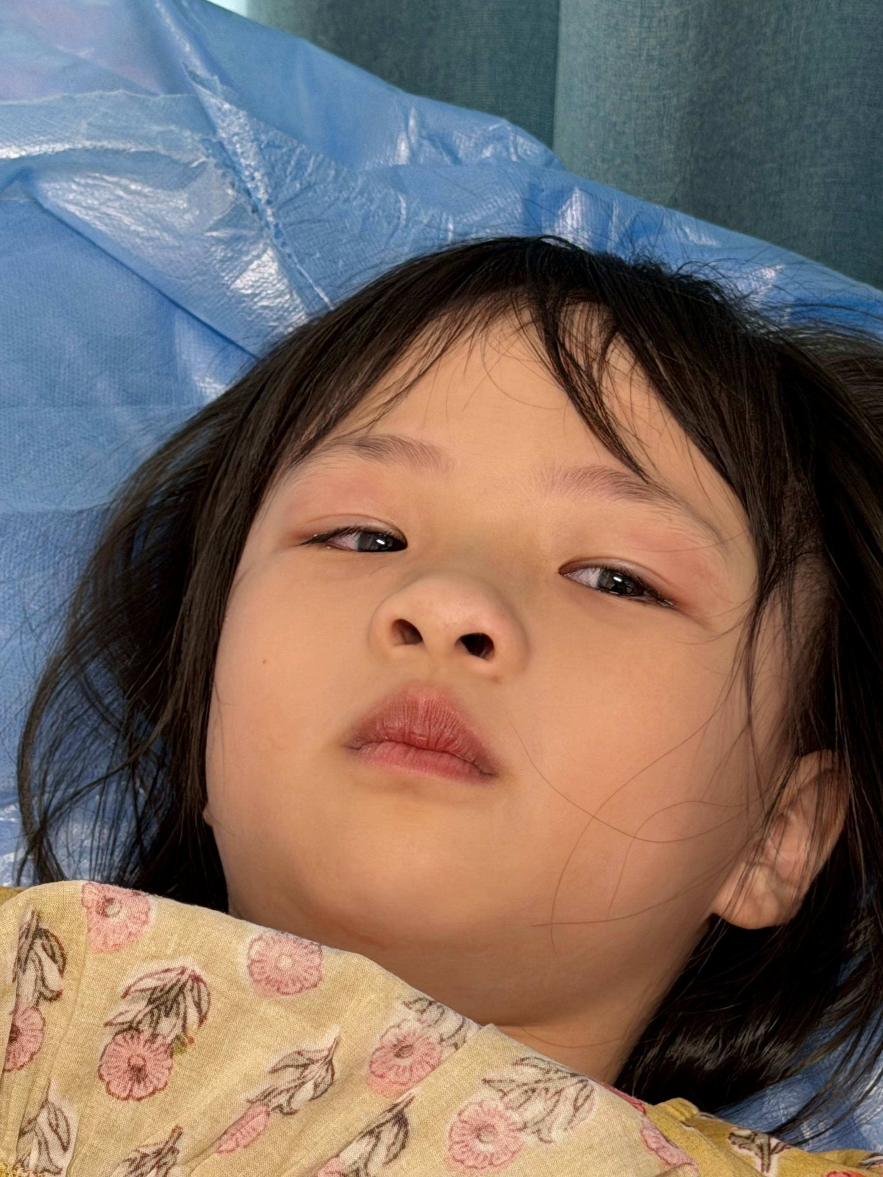 太好笑了这个是在做心电图心电图其实一点不疼的但是阿丘因为抽血哭了还有点在吸鼻子医