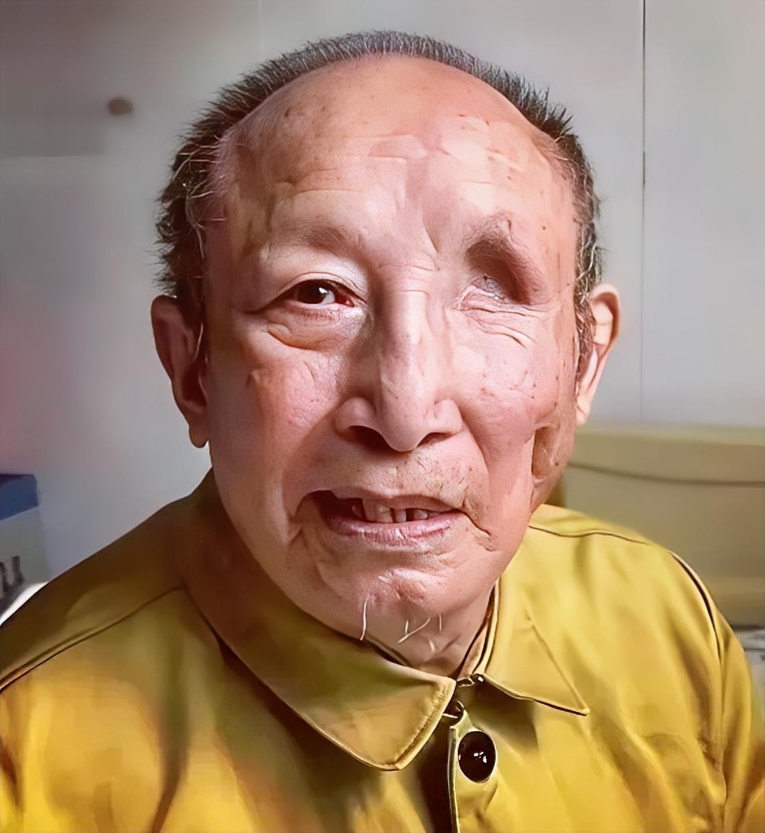 抗美援朝老兵刘希枝，在朝鲜战场上被地雷炸伤，左眼失明，头部残留7块弹片，伴随老人