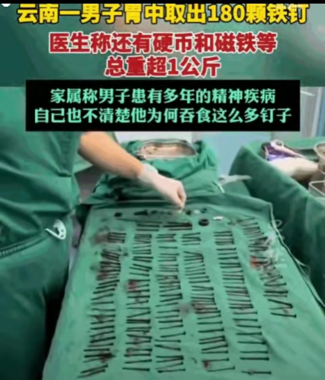 解释不清了！云南，一男子腹部剧痛送医，医生检查后当场被吓退三分：他体内居然塞满了