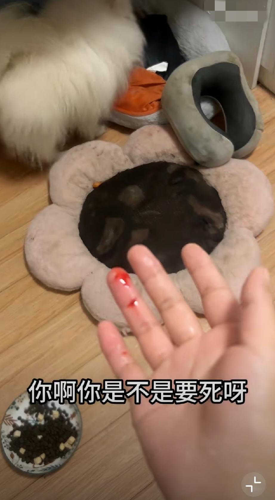女子吐槽：养了5年的小狗，以为我抢它吃的给我咬伤了！未栓绳狗伤人 未拴绳狗伤人 