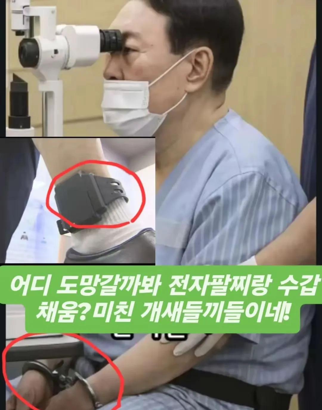 对尹锡悦的关押，整个看守所还是实行人性化的。由于尹锡悦的眼部存在疾病必须得检查，