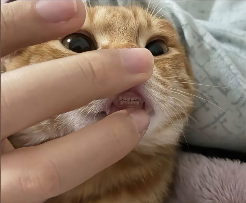 牙齿护理很重要 ​​​
