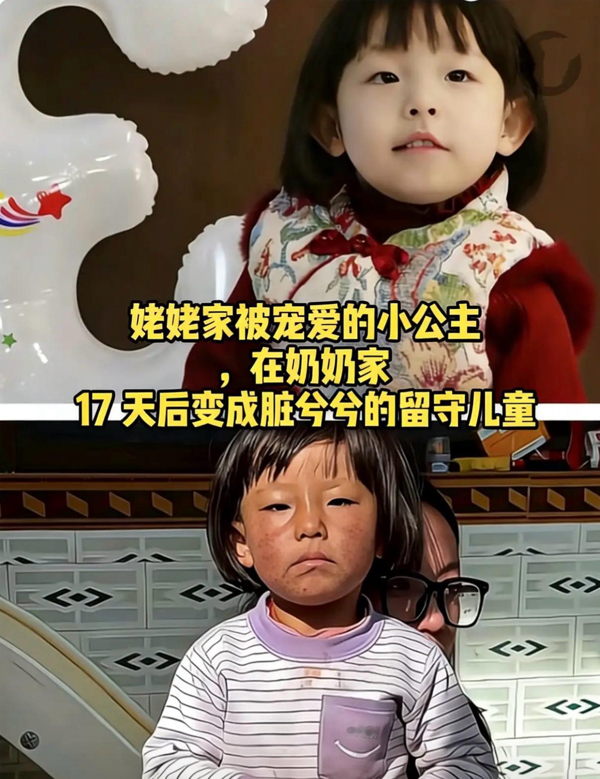 17天，涵涵从“小公主”变成“小可怜”，看得人心都揪紧了！


妈妈早逝，小姨和