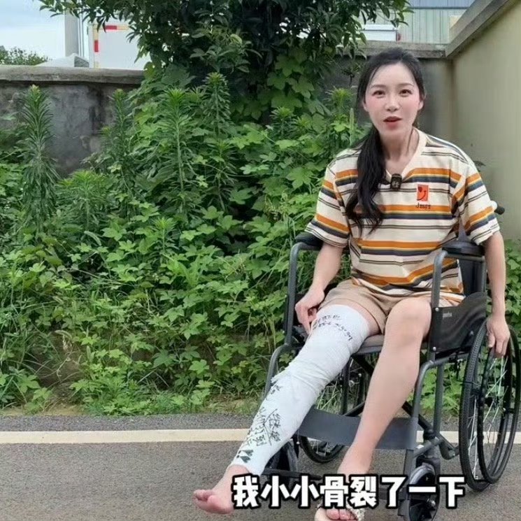 网红小贝饿了腿骨裂了大家还是要注意安全 祝小贝早日康复 