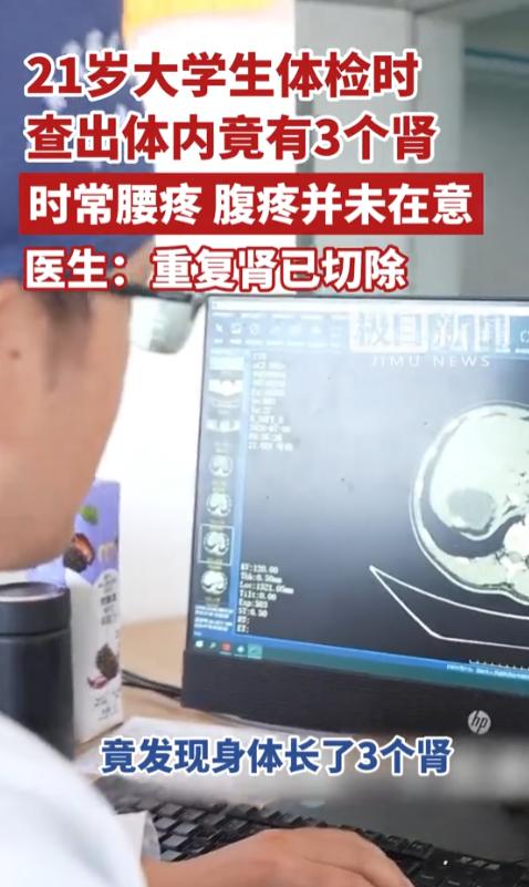 太离奇了！湖北某高校21岁大学生，长期被腰腹隐痛困扰却总以为是熬夜复习、久坐刷题