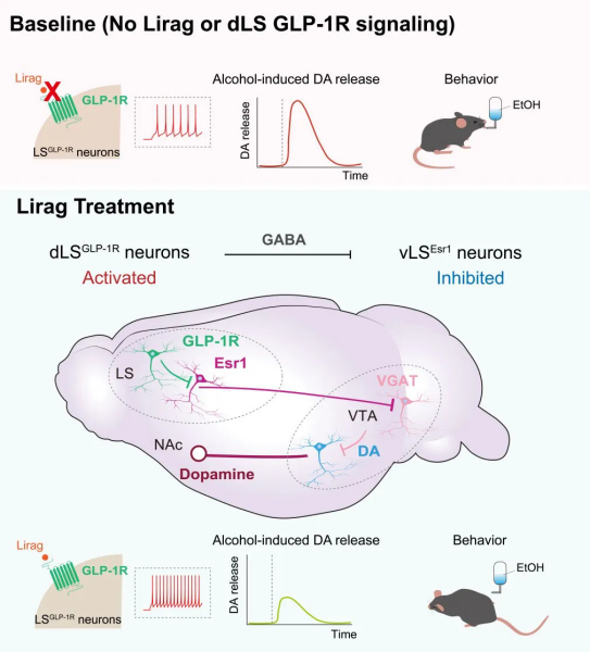【减肥降糖药能够帮助戒酒？】酒精使用障碍（俗称“酒精成瘾”）是一种慢性且易复发的