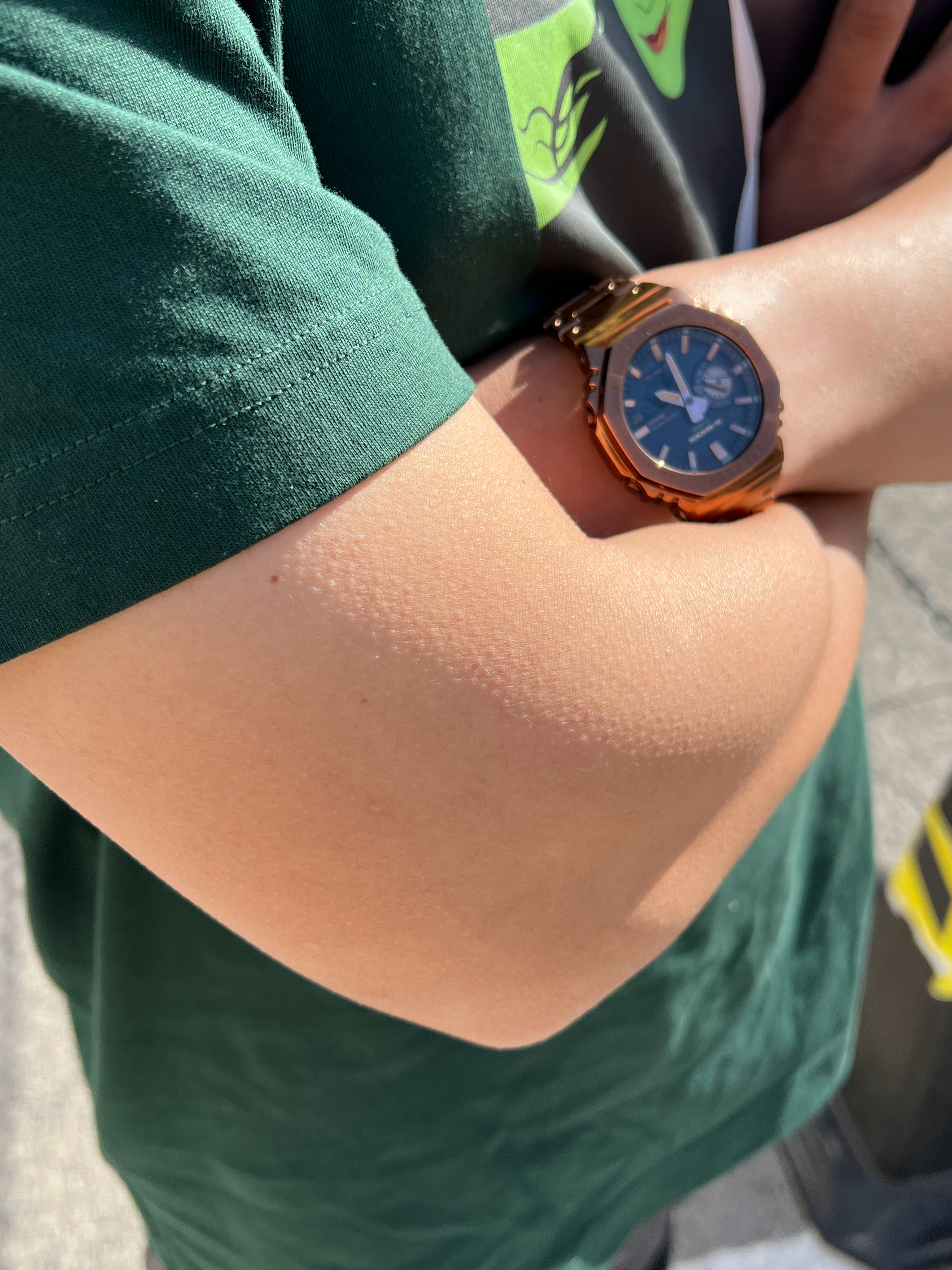 我问他冷吗他说不冷看这个鸡皮疙瘩，大家伙信吗 天津·翠亨村