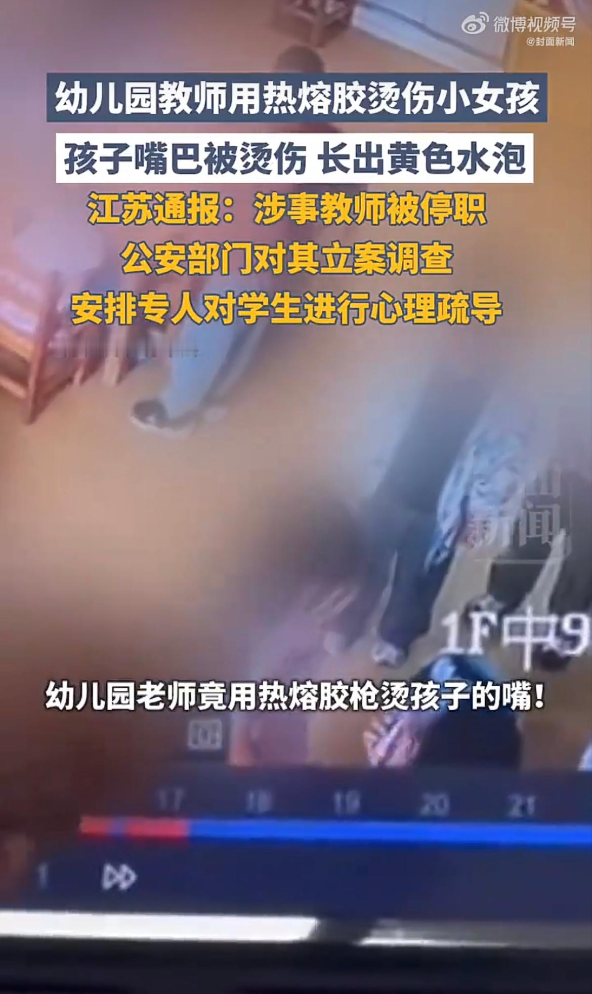 热熔胶烫伤嘴唇也烫坏家长信任一桩看似偶然的校园小意外，实则撕开了托育与校园安全管