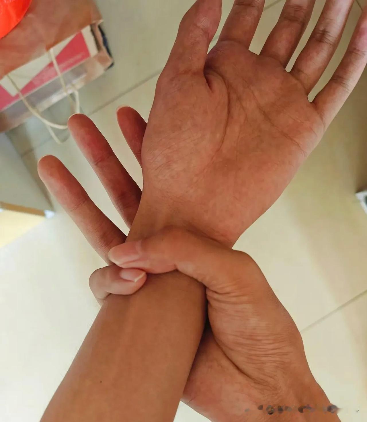 现在的病真的是太稀罕了，长这么大还是第一次听说什么马凡综合症。过年走亲戚遇到我二