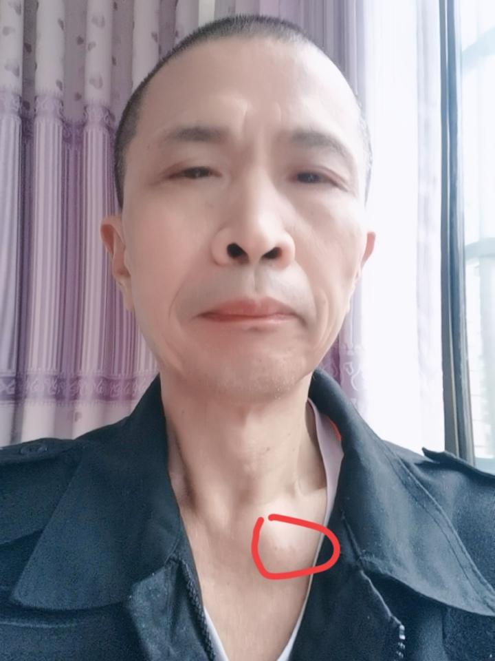 今天，我在无意间，手掌又触碰到这个地方，发现骨端处比以前又往上长了一些，大了一些