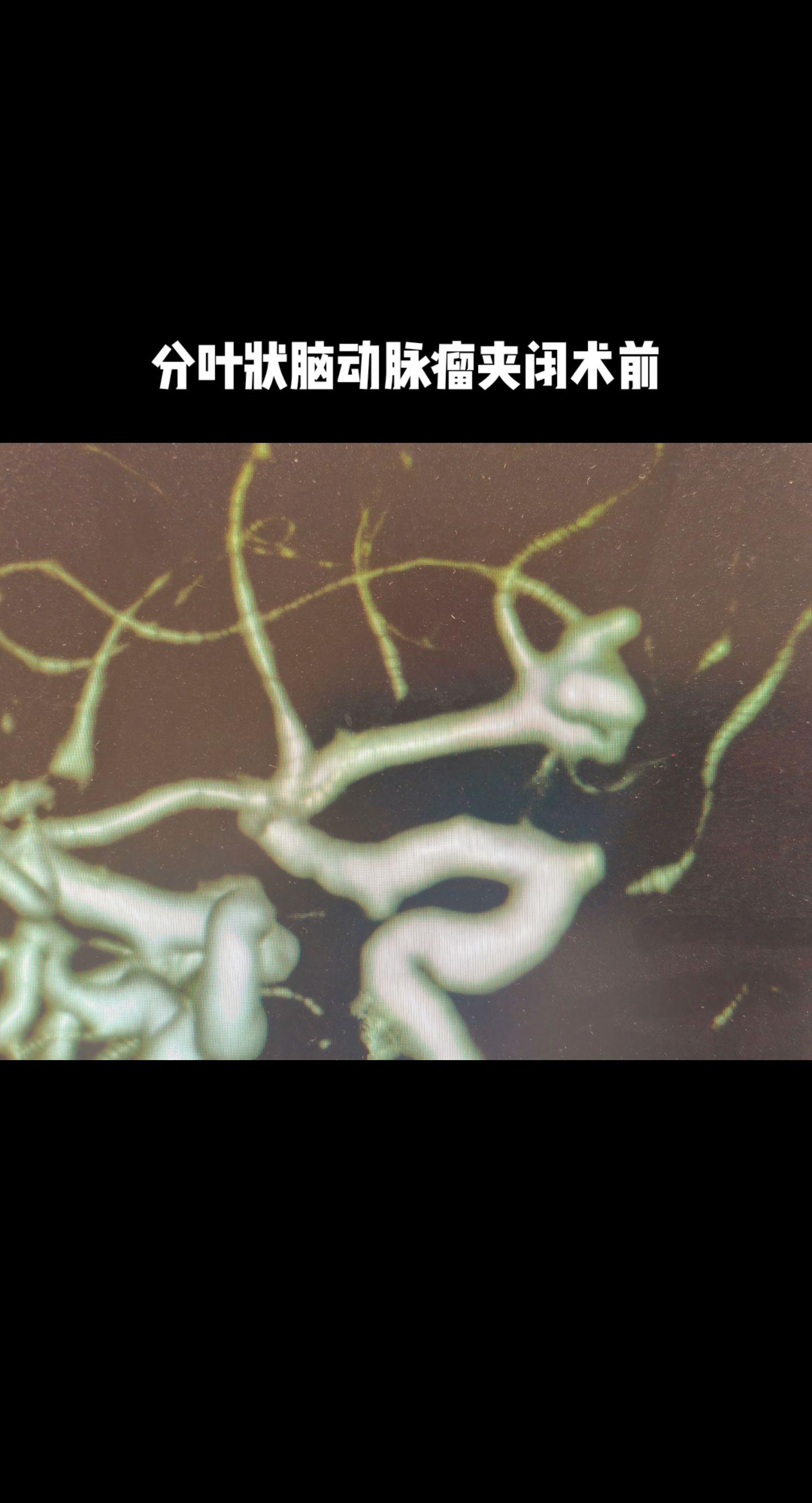 手术室日常 医路有你 医者仁心