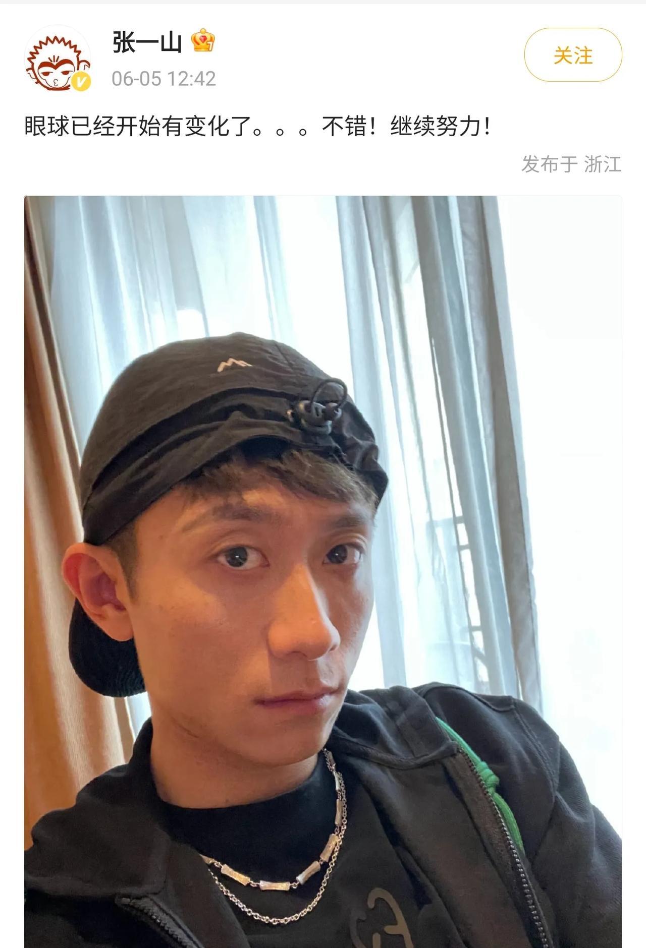 张一山莫名其妙发文，说自己眼睛开始有变化了，很不错。
但评论区里的网友看了半天也