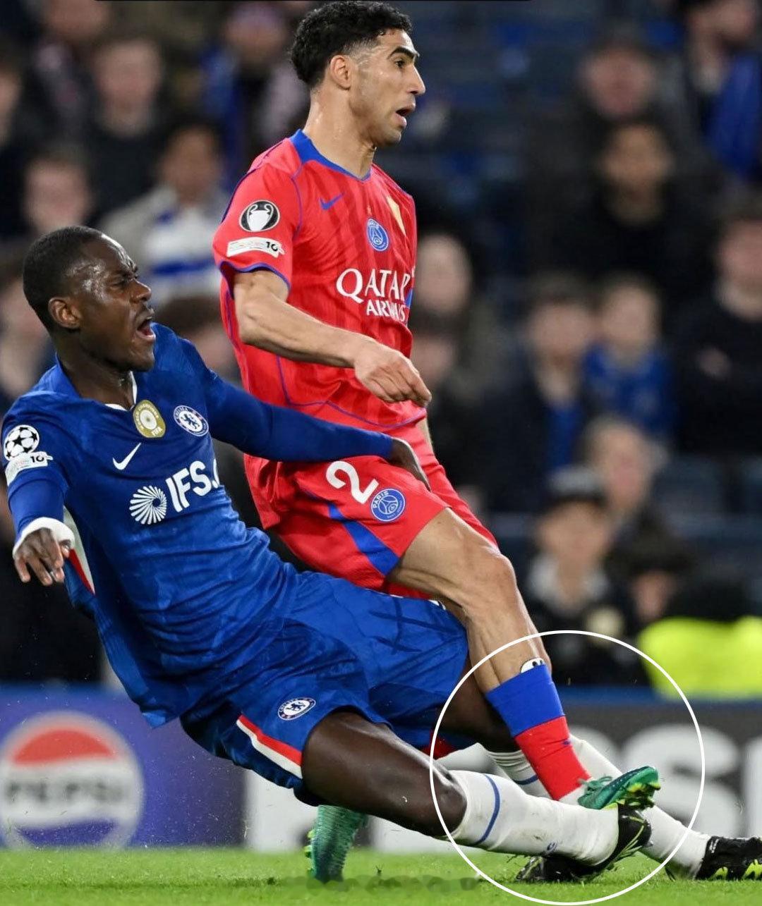 查洛巴受伤 切尔西0比3巴黎圣日耳曼【查洛巴脚踝变形】这场比赛的最后时刻，切尔西