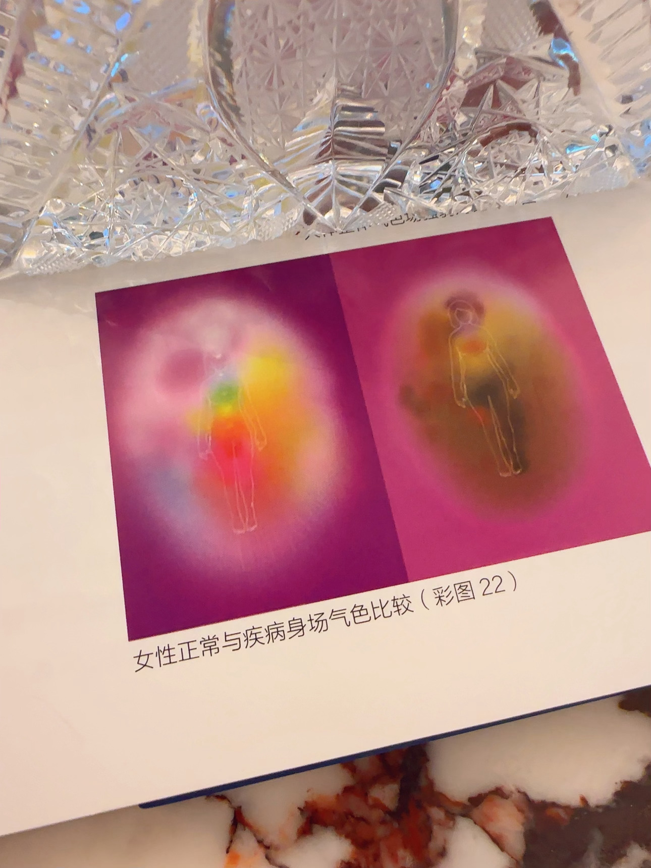 书上还是写保守了，身上跟着yqzz也是右边这种，还发黑灰……气灰黑，人面色也灰黑