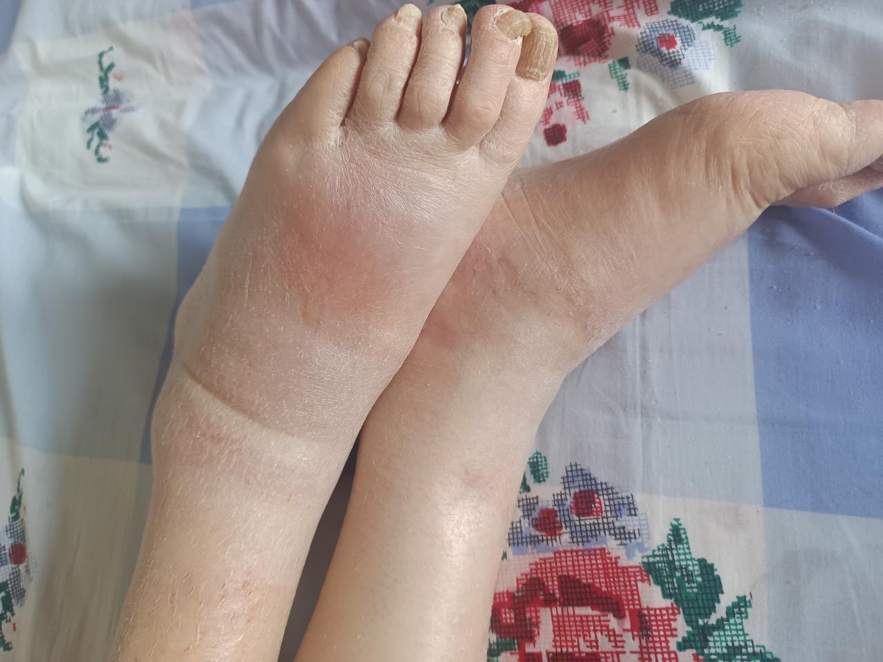 出院8天，昨天又住院了。算算从来烟台老家居住将近20个月，这是第8次住院，也有点