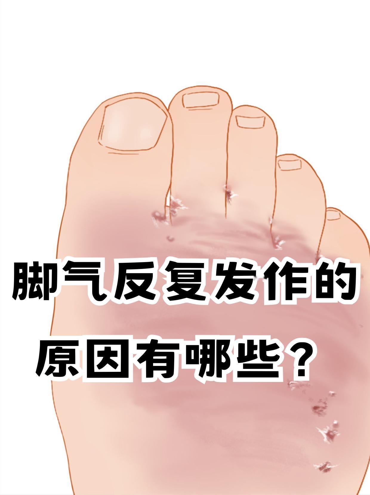 为什么脚气总是反反复复好不了？






对于脚气很多人不陌生，这个问题总是反