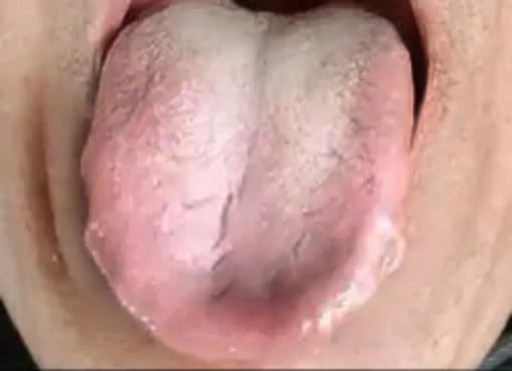 体内有瘀，若只吃血府逐瘀的话，相当于野火烧不尽，春风吹又生！加上这一味，帮你除尽