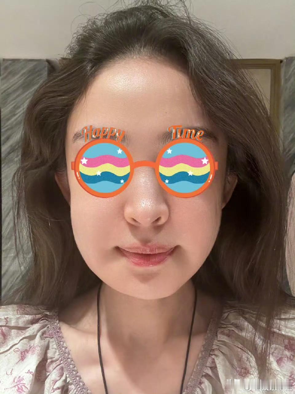 嫉妒让人失去理智
娜扎说她因为牙龈肿了，连带着脸也肿了！
还发了图片，可是这不就