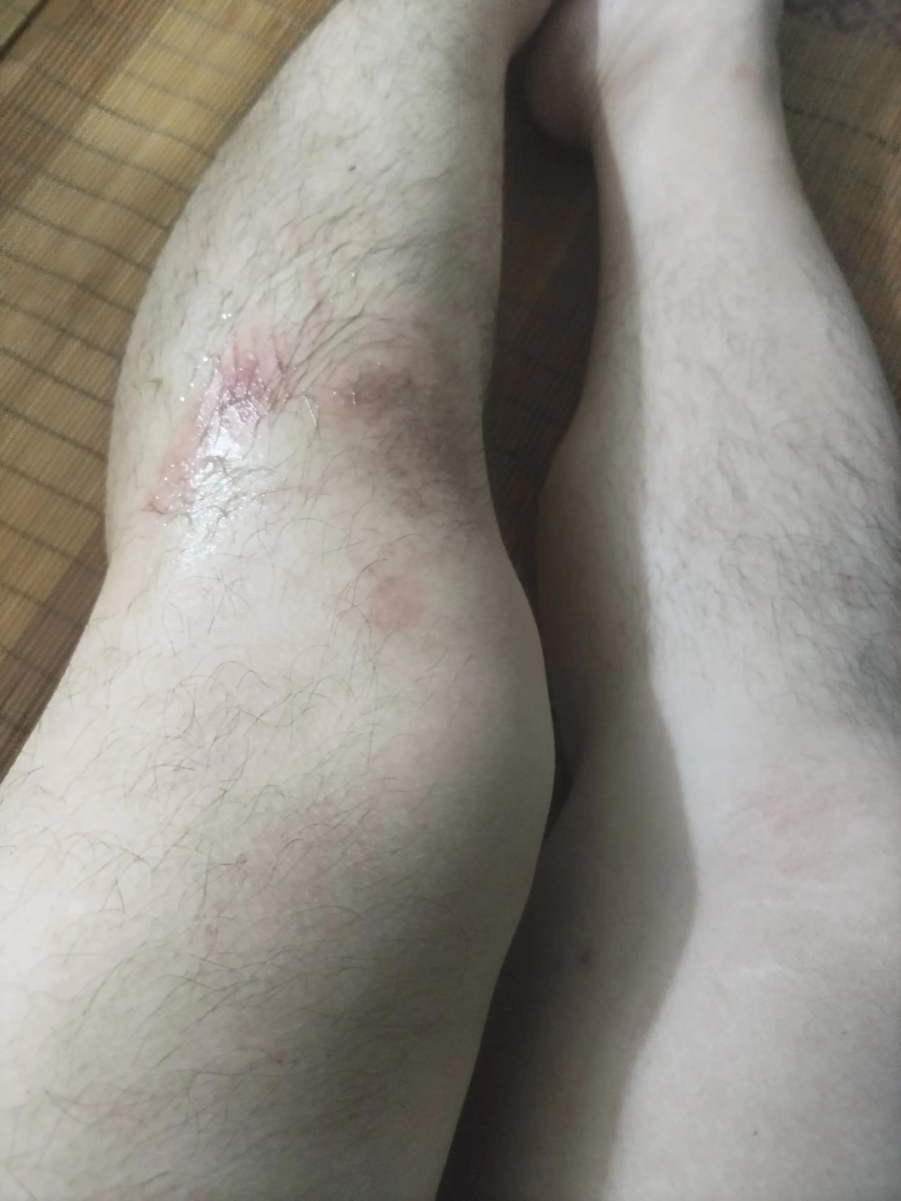 门口摔了一跤