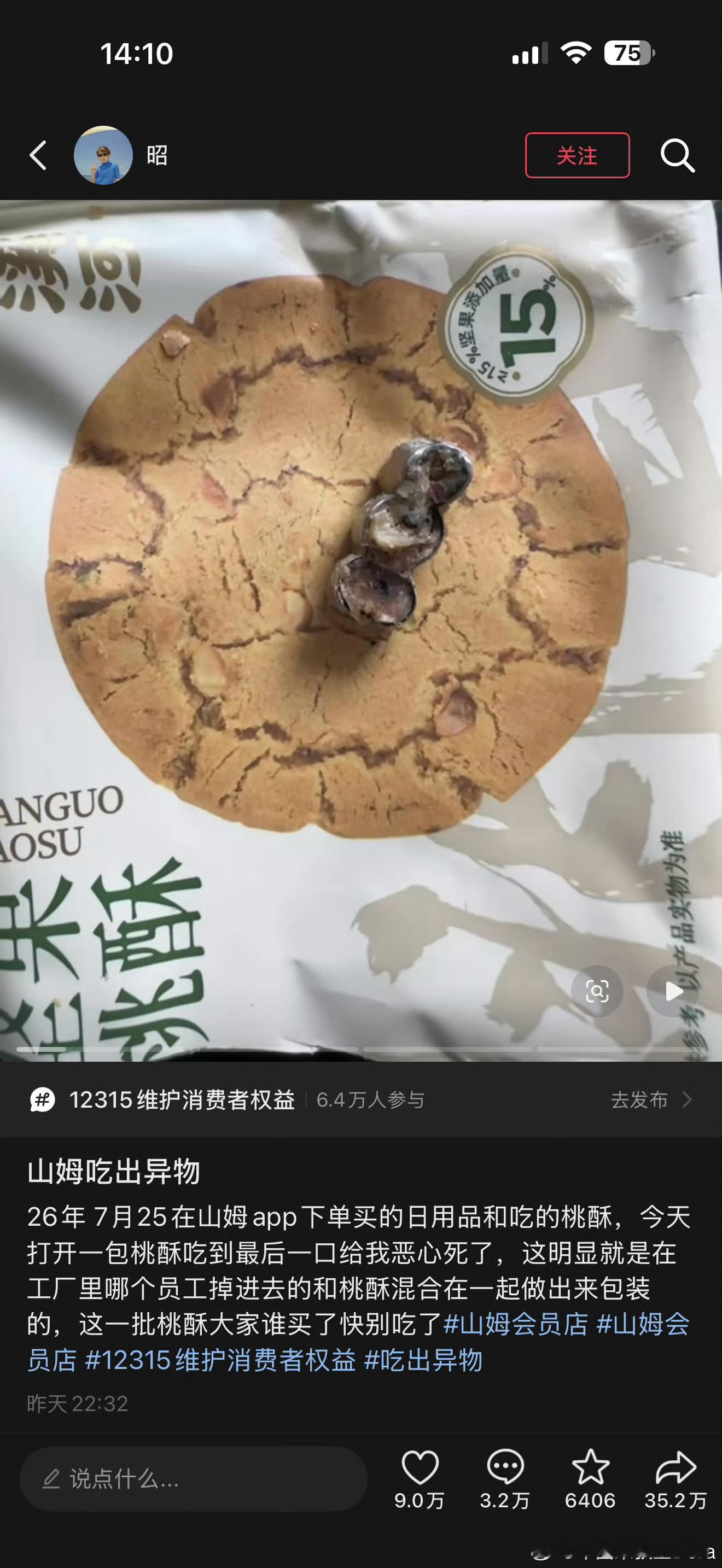 妈呀，正在吃午饭，看到这个帖子被吓死头发啥的也就实在是忍了，这个假牙到底是什么情