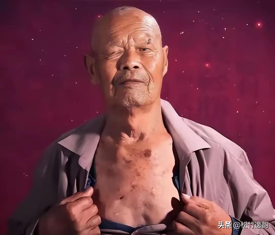一个山东大哥，咳嗽了十年。某天在地里干活，咳得惊天动地，突然"哇"一声，从嘴里喷