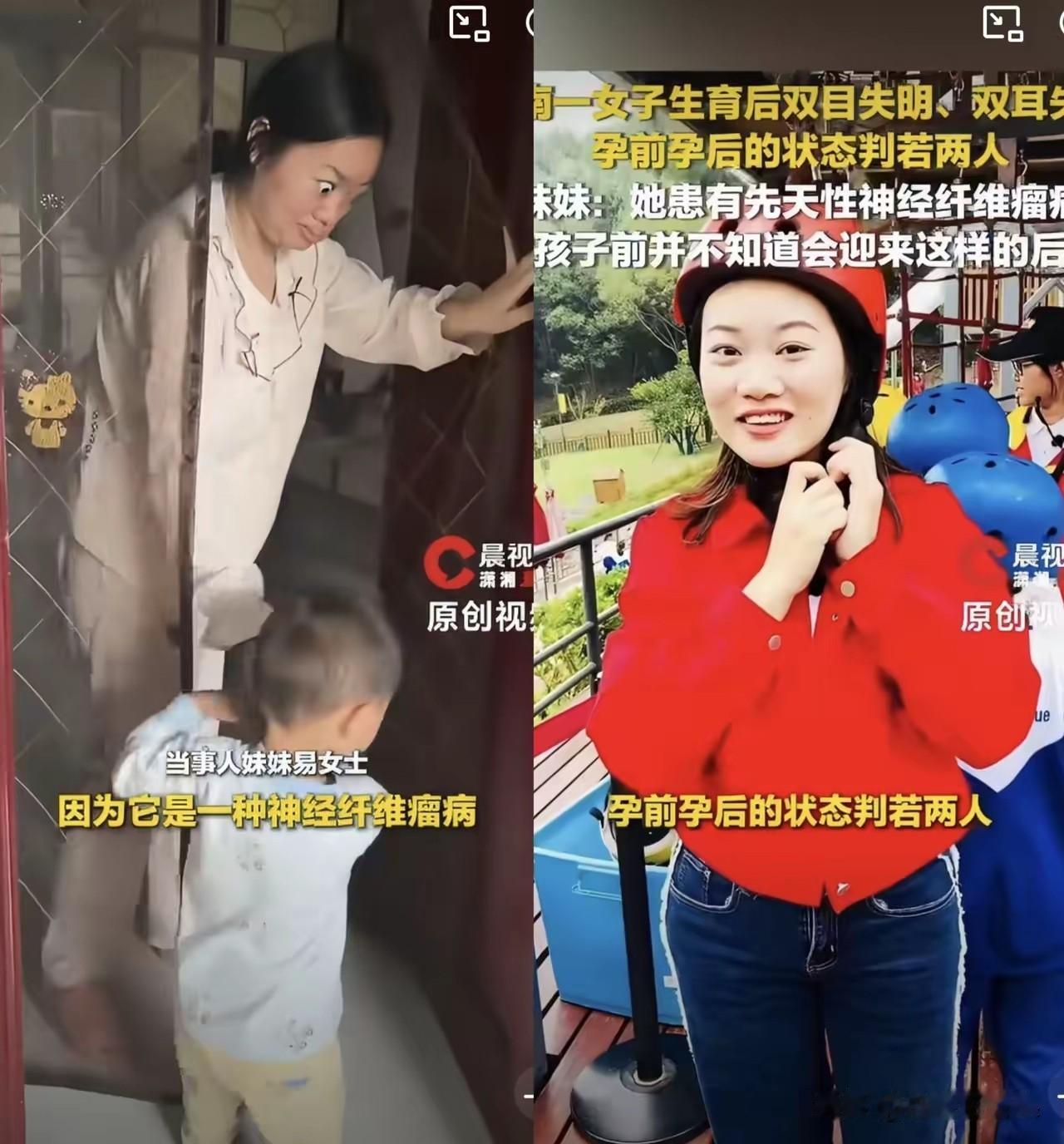 湖南这位女子，孕前阳光漂亮，谁也想不到，生完孩子之后，直接双目失明、双耳失聪。