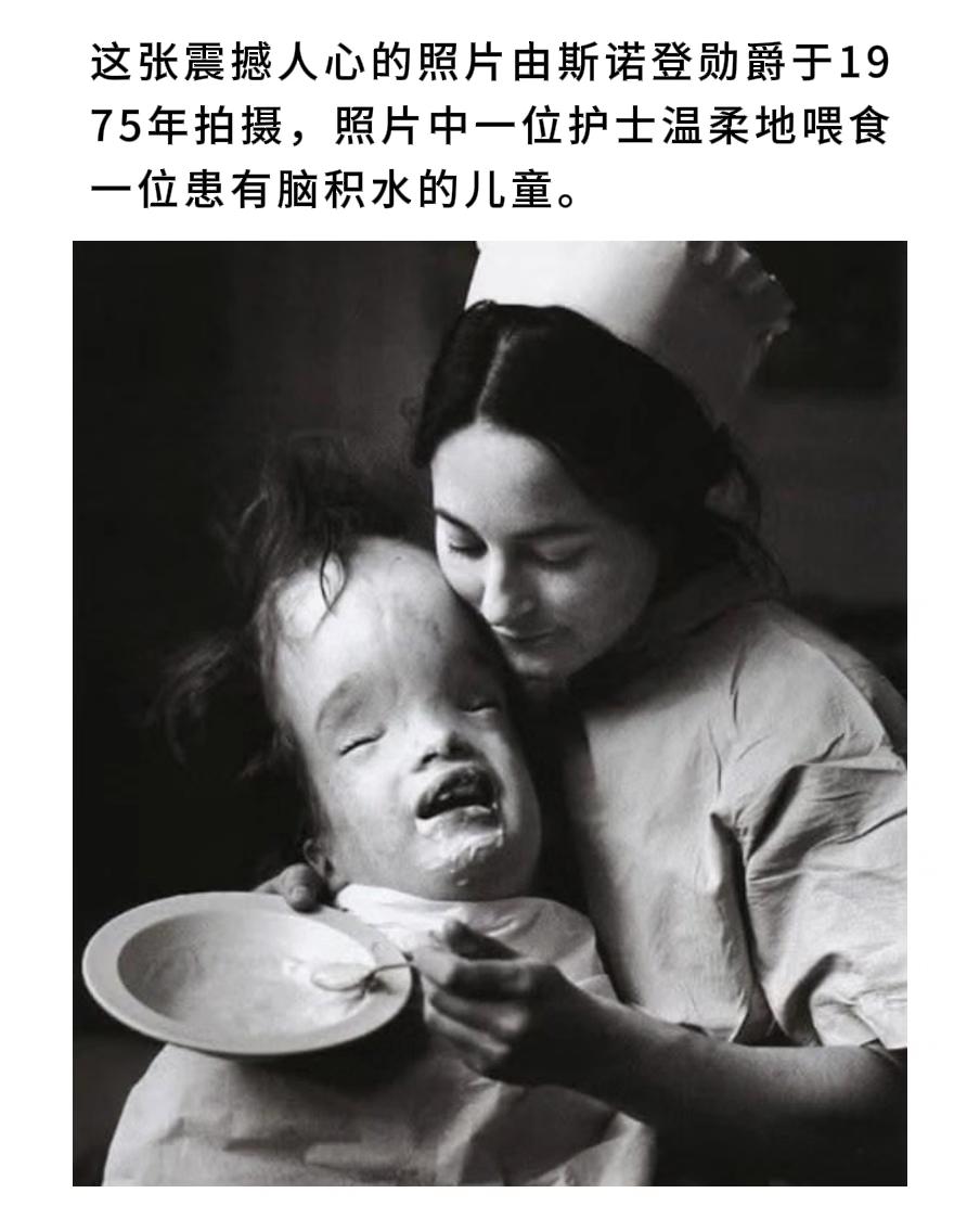 这张震撼人心的照片由斯诺登勋爵于1975拍摄，照片中一位护士温柔地喂食...
