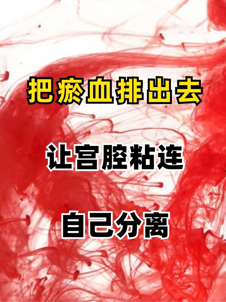 把瘀血排出，宫腔粘连自己分离❗
