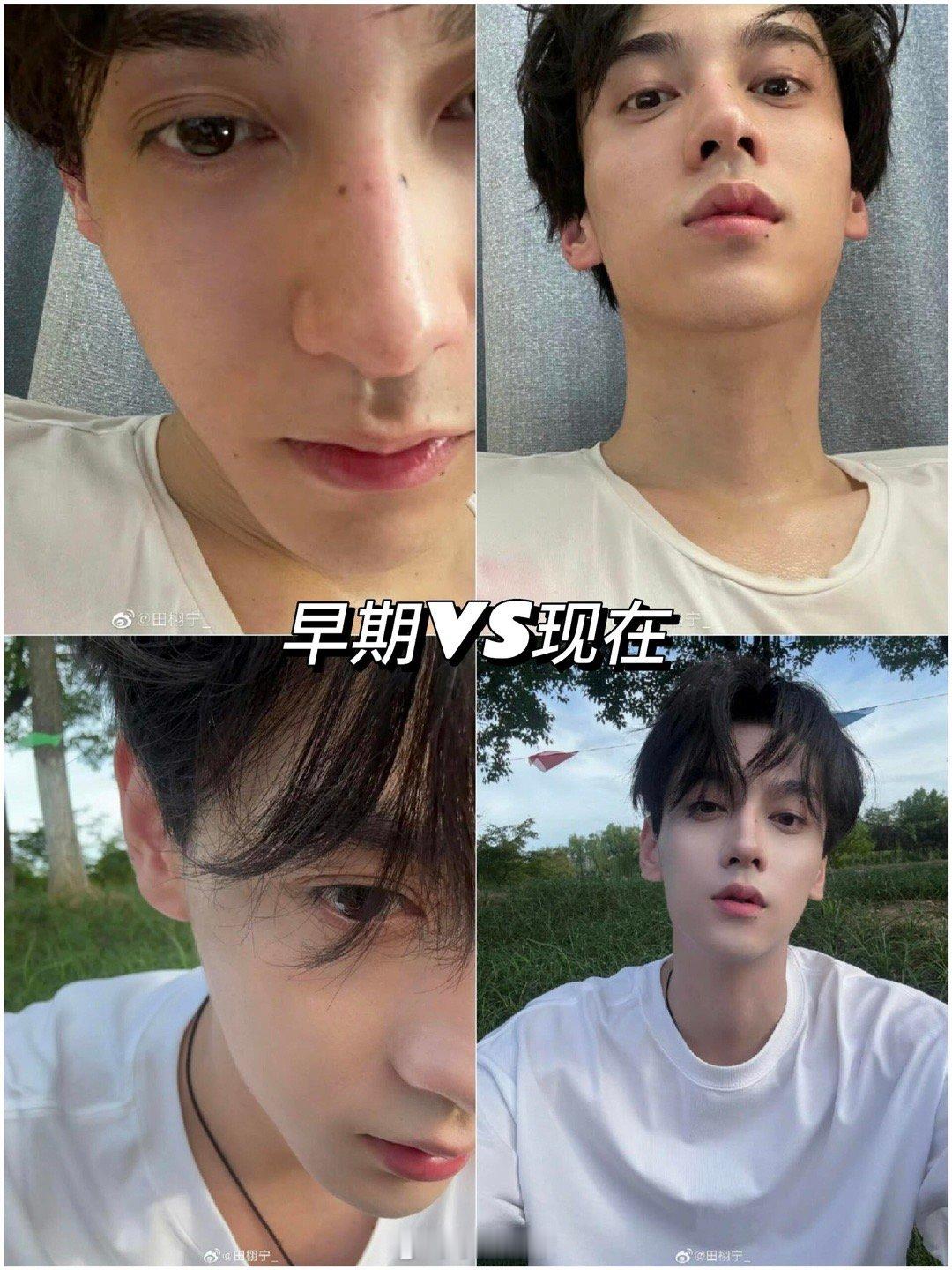 田栩宁[超话]  对比一下雷子早期的图和今天早上刚发的图感觉我哥更温柔了，是化妆